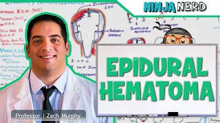 Epidural Hematoma | Anatomy, Etiology, Pathophysiology, Clinical Features, Treatment