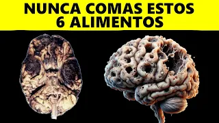 Alzheimer: EVITA estos 6 alimentos PROHIBIDOS a toda costa