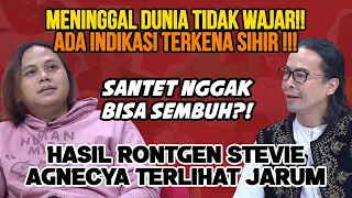 ADA DUA BENDA ASING DI TULANG EKOR STEVIE AGNECYA. KI PRANA LEWU: MENINGGAL KARENA ILMU HITAM??