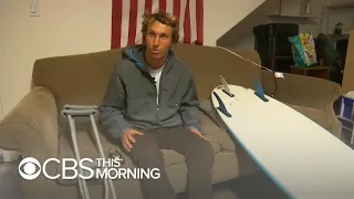 California surfer bitten by shark on "miraculously" surviving attack