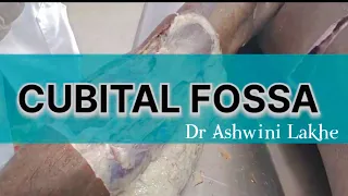 CUBITAL FOSSA(Cadeveric dissection) showing - boundaries, contents and clinical importance