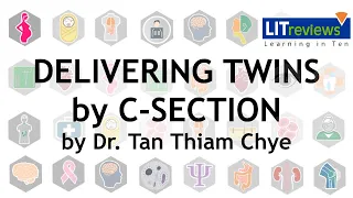 Delivering Twins by C Section by Dr Tan Thiam Chye