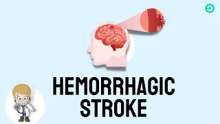 Hemorrhagic stroke: causes, symptoms and diagnosis, treatment options