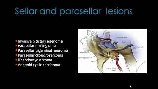 16 Skull base Imaging ( part 3) - prof.Mamdouh Mahfouz (2019 edition)