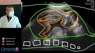 Ultrasound BABY SEX! Boy or girl? Pregnancy 20 weeks.