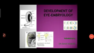 Development of eye- embryology easily explained