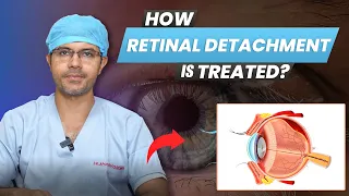 How Retinal Detachment Treated? | Retinal Detachment Signs, Symptoms & Treatments