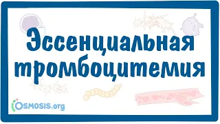 Эссенциальная тромбоцитемия — причины, симптомы, патогенез, диагностика, лечение