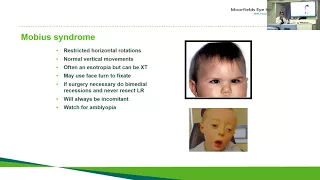 Special Forms of Strabismus: Dr. Gillian Adams