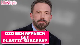 Did Ben Affleck Get Plastic Surgery Done? | Life & Style News