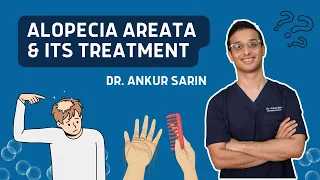 Alopecia Areata Treatment | Injections natural remedies treatment in Hindi | Dr. Ankur Sarin