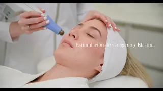 Exilis Ultra 360 FACIAl