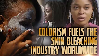 Colorism Fuels The Skin Bleaching Industry Worldwide