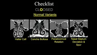 Pre-op FESS Checklist - Dr. Suresh Mukherji - MRI Online