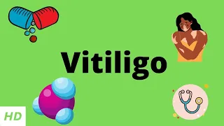 Vitiligo, Causes, Signs and Symptoms, Diagnosis and Treatment.