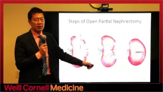 Diagnosis and Treatment of Small Renal Masses - Jim C. Hu, MD, MPH