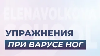 О-образная форма ног или варус.