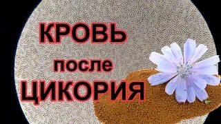 Кровь после цикория