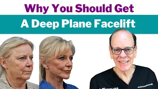 A Deep Plane Facelift Explained | Facial Plastic Surgeon's Advice