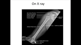 FRCR Radiological anatomy course upper limb  2 ( Arabic edition ) .