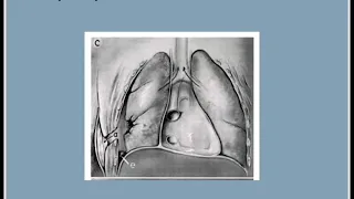 Primary Survey in Trauma - Breathing