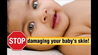 7 Tips For Baby's Skin Care| Momjunction Hacks