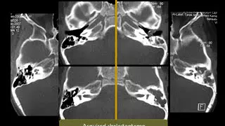 Dr Mamdouh Mahfouz head and neck imaging pathology of the Petrus Bone II