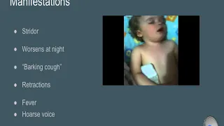 Croup Presentation