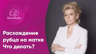 Расхождение рубца на матке: что делать? Акушер-гинеколог