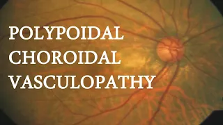 OCT in PACHYCHOROIDAL VASCULOPATHY