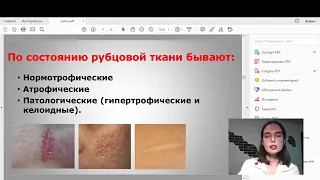 Вебинар - Эффективное лечение и профилактика рубцов.