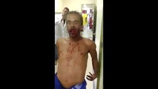 Homem manifestado com DEMÔNIO e baleado no rosto chega em hospital e debocha de funcionários!