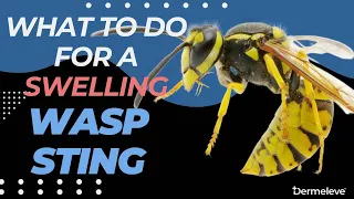 Wasp Sting Still Swelling After 48 hours? Here's What You MUST Know!