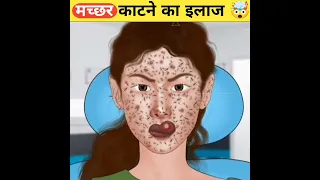 मच्छर काटने का इलाज 🤯😱।Mosquito bite treatment👨‍⚕️#shorts#MRFarook#viral