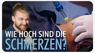 Wie SCHMERZHAFT ist eine Haartransplantation?