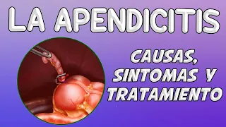 LA APENDICITIS, Causas, síntomas, diagnóstico y tratamiento