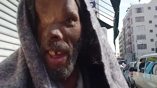 Skid row resident has half his face blown away by a shotgun and lives to tell about it