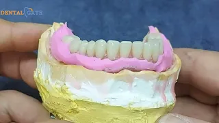 waxing the "polishing surface" of lower denture with contour of neutral zone