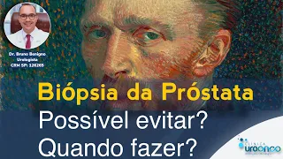 Biópsia de Próstata | Possível evitar? Quando Fazer?  Dúvidas frequentes.