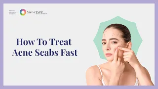 How to Heal Acne Scabs Fast and Easy with Dr. Leslie Baumann