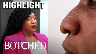 3 BAD Nose Jobs From a Cosmetic Surgeon | Botched | E!