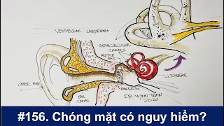 #156. Chóng mặt có nguy hiểm?