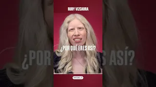 La vida de una modelo albina mexicana