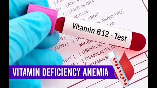 Vitamin deficiency Anemia ( Complete Overview )