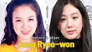 Jung Ryeo-won before and after