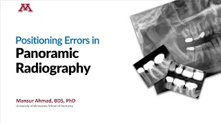 Positioning Errors in Panoramic Radiography
