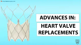 Webinar: Advances in Heart Valve Replacement with Dr. Arghami & Dr. Eleid of the Mayo Clinic