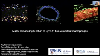 "Matrix remodeling function of Lyve-1+ tissue resident macrophages" by Dr. Veronique Angeli