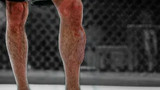 Leg Kicks From Hell | Leg Kicks That Caused Damage | MMA & Muay Thai