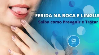 Ferida na Boca e Língua: Saiba como Prevenir e Tratar